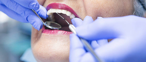 Best Emergency Treatment for Dental Infections or Abscesses in Ruch, OR